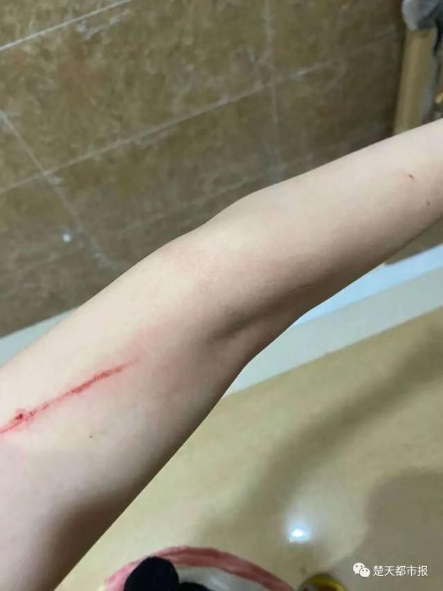 女子正洗澡一声巨响后瞬间被划伤12处至今无法正常上班
