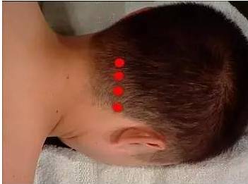 原始点疗法此生不得不学的救命疗法附最新最全真人演示全身原始点位置