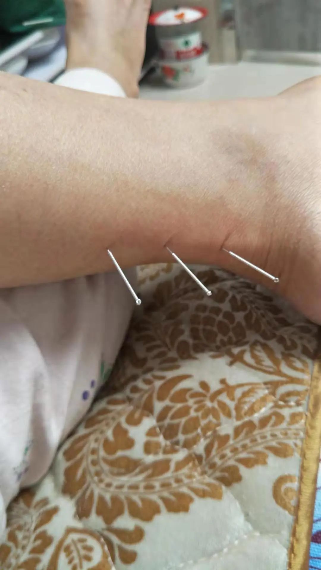 七七部小腿正筋穴正宗穴正士穴