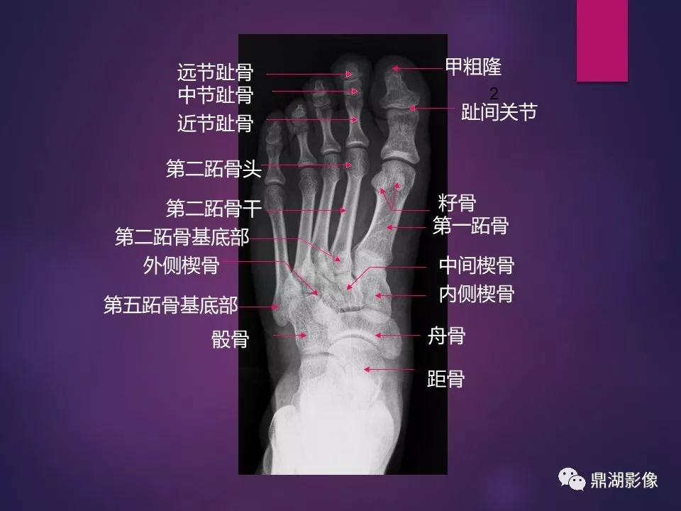骨肌系统x线解剖图册案前必备